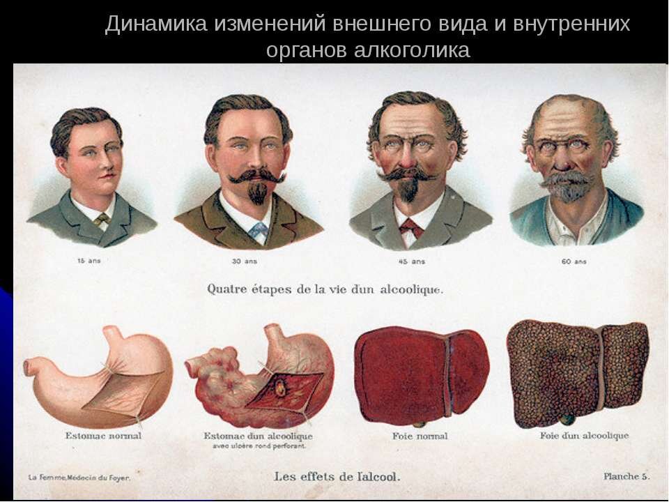 Открытый источник.