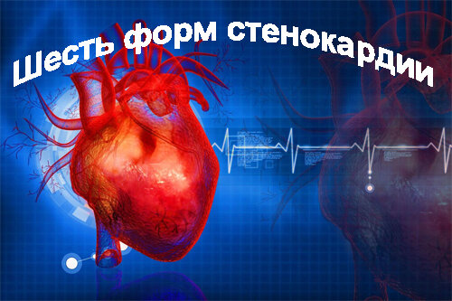 шесть форм стенокардии