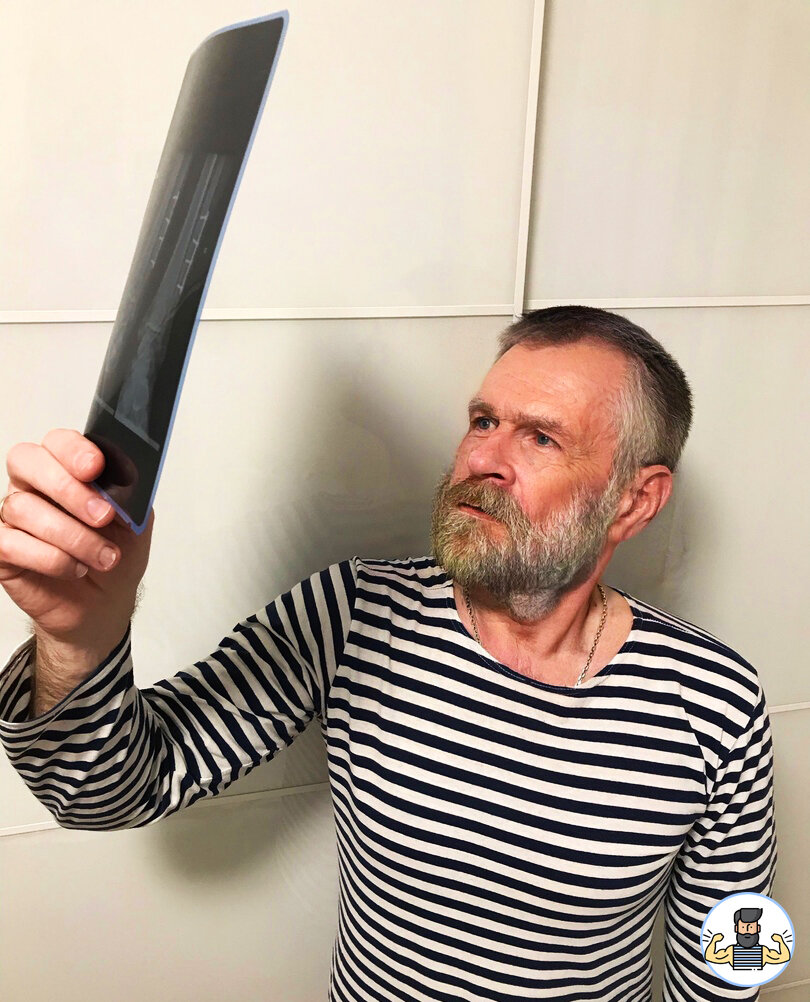 На память остался снимок сустава