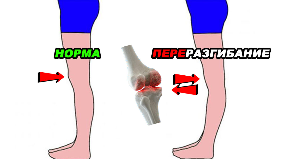 Автор - Пенкин Егор/Fit.Therapy.Official