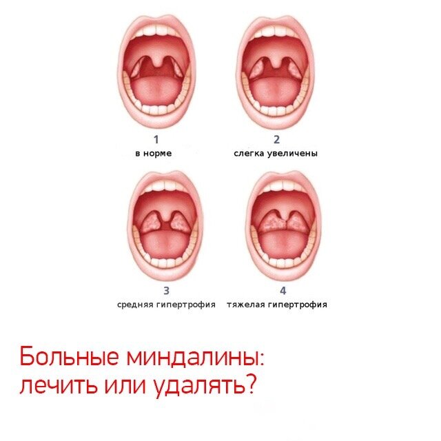 Стоковые фотографии по запросу Миндалин