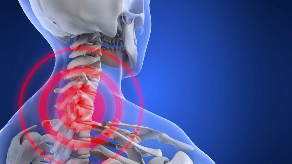 Шейный миозит — симптомы, причины и первая помощь в домашних условиях, лечение в СПб
