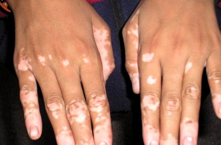 Взято из открытых источников