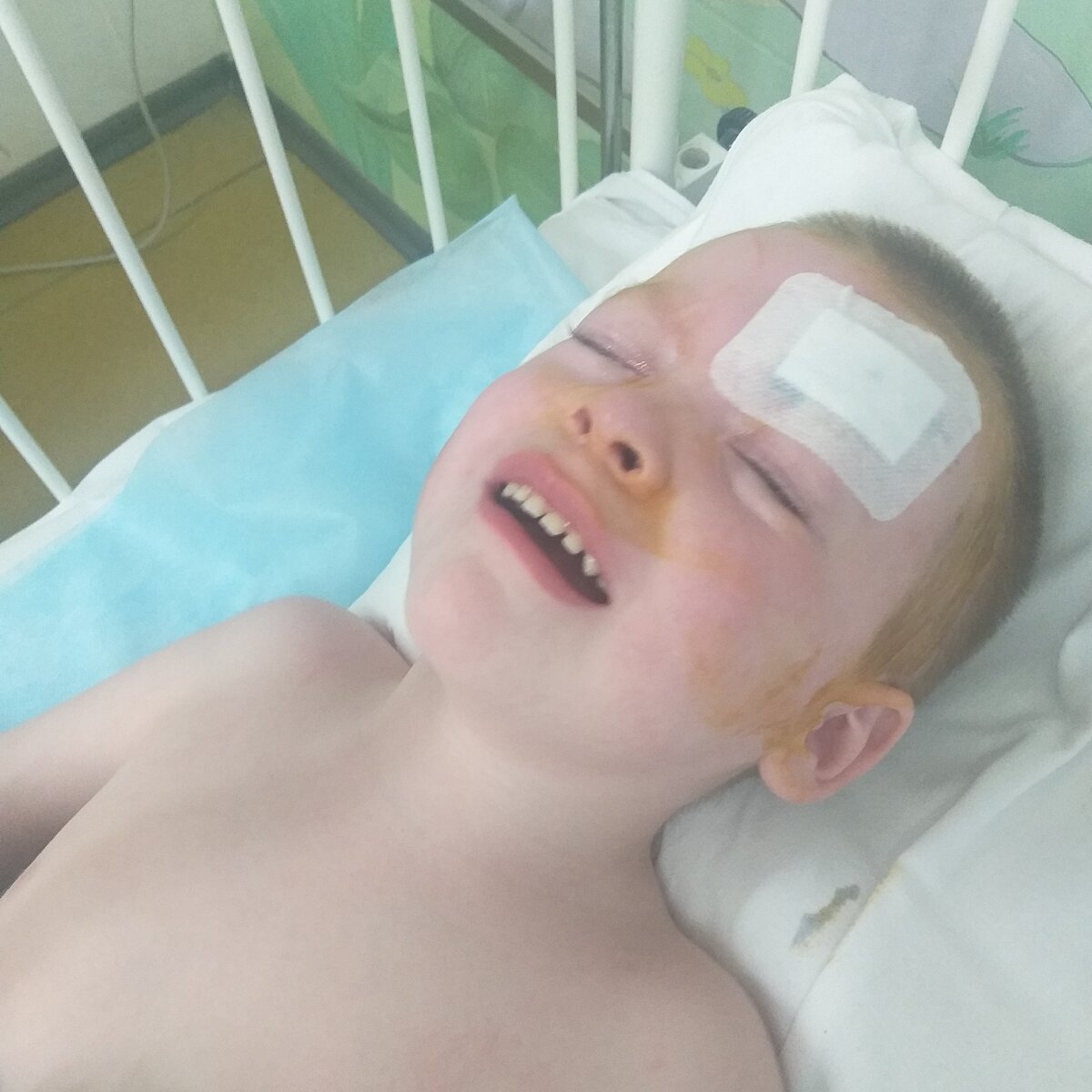 После второй операции, выход из наркоза