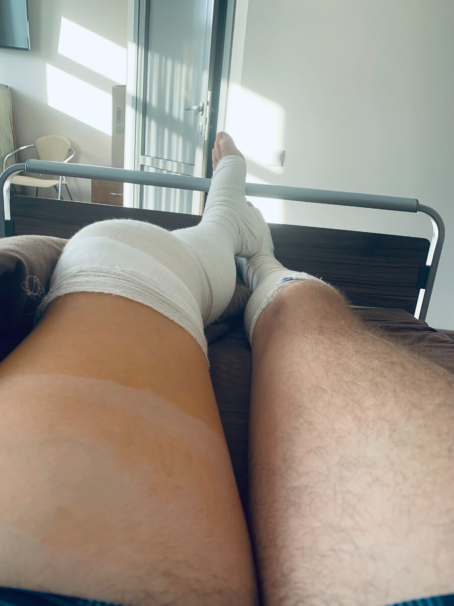 На следующий день, я уже мог делать вот так))