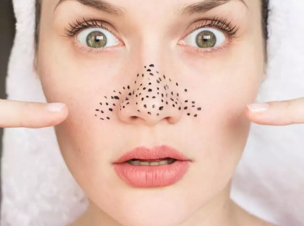 Фото с сайта: www.syl.ru