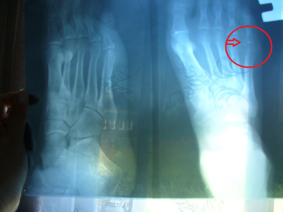 Фотографировала на фоне окна, так что узоры на снимке - это штора)