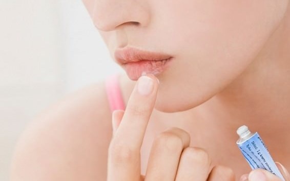 лечение герпеса