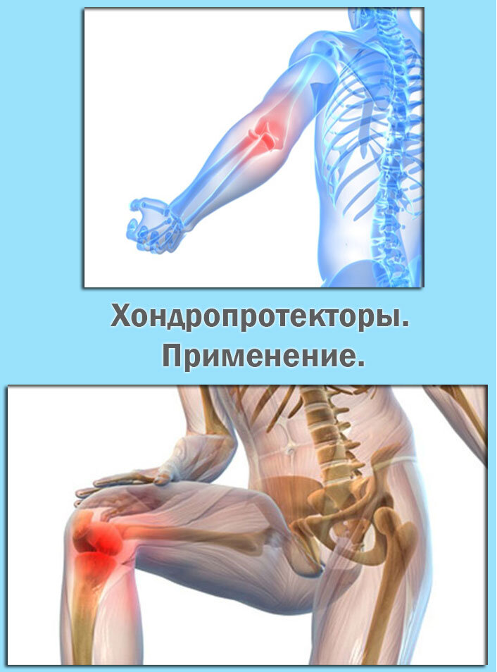 Остеоартроз хондропротекторы. Хондропротекторы для позвоночника при протрузии поясничного отдела. Хондропротекторы после операции на позвоночнике. Хондропротектор при спондилезе.