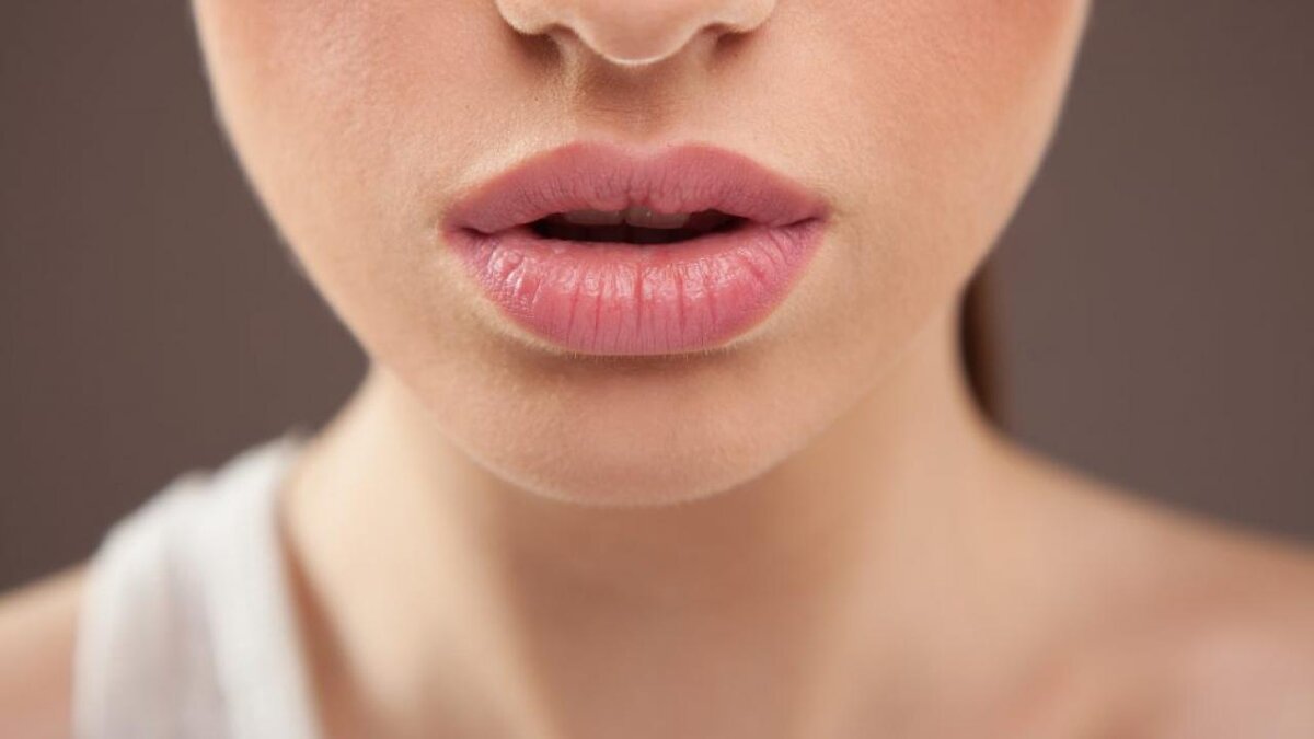 Важна ли техника увеличения губ?