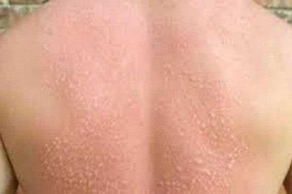 Источник: https://www.google.ru/imgres