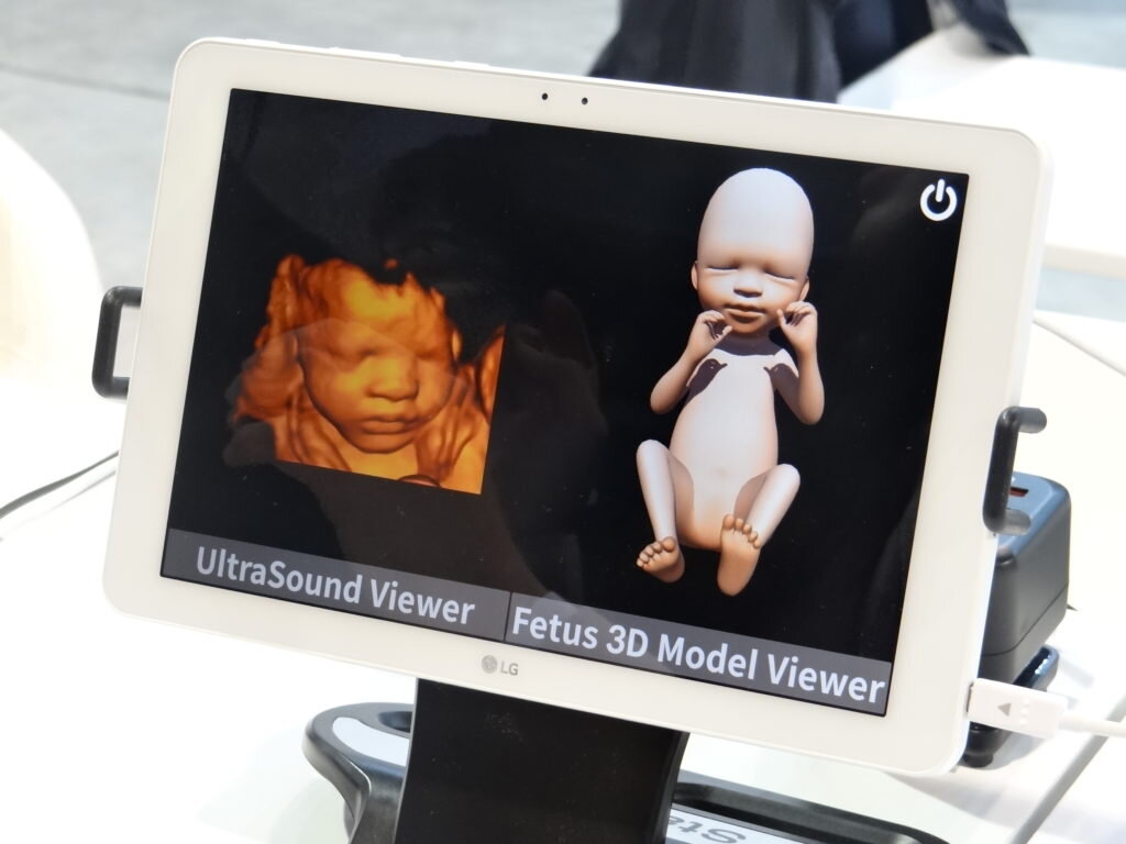 Увидеть своего еще неродившегося ребенка с помощью УЗИ и VR 