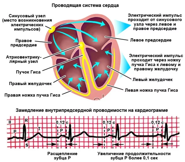 Экг сердца презентация