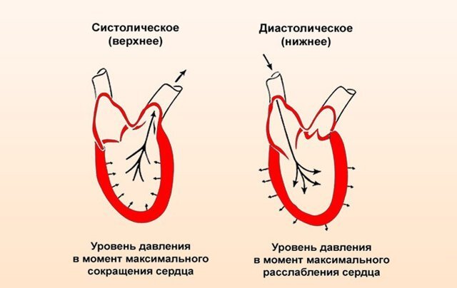 Головная боль от давления?