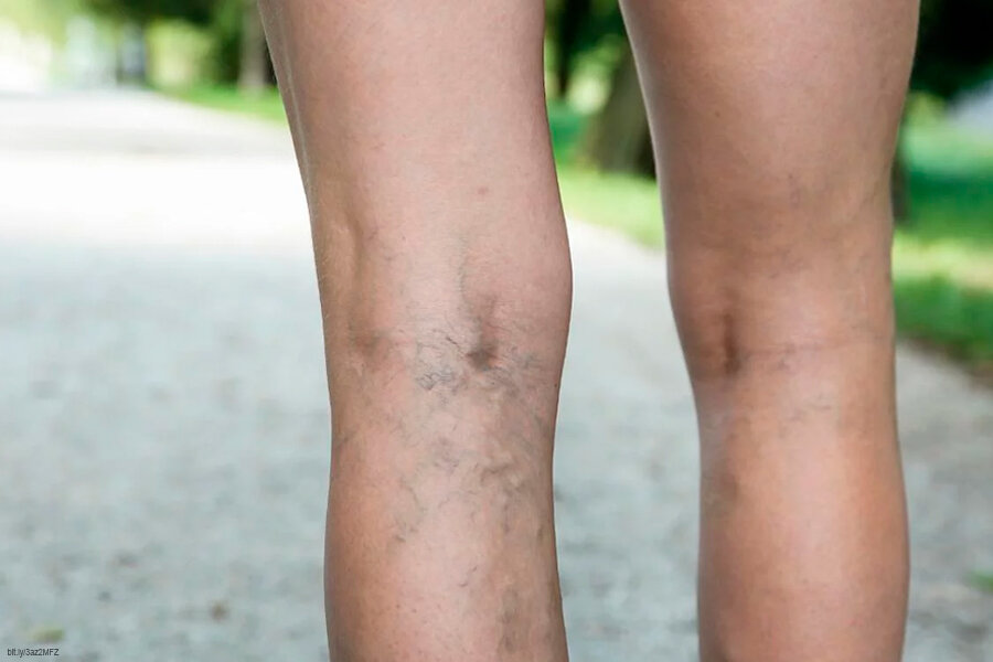 Фото свободного доступа