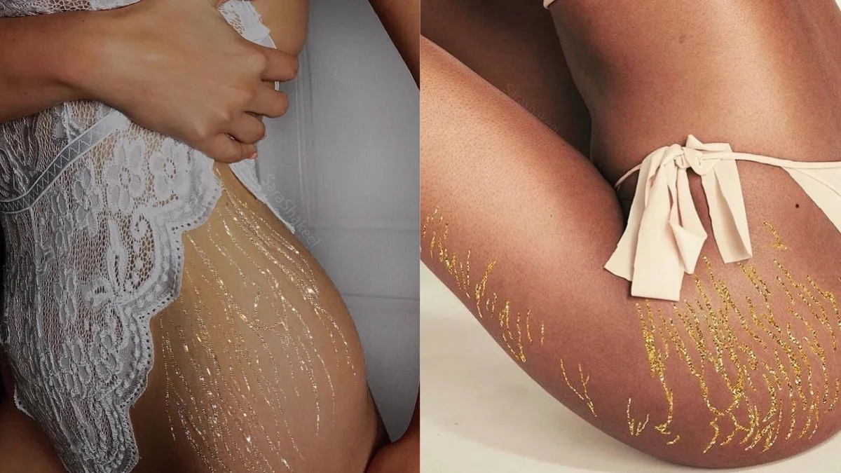 Фото : "lifestylemedia.biz"