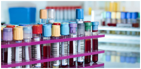 Do not "hang over" the indicators. All hormonal blood parameters are interrelated!!!