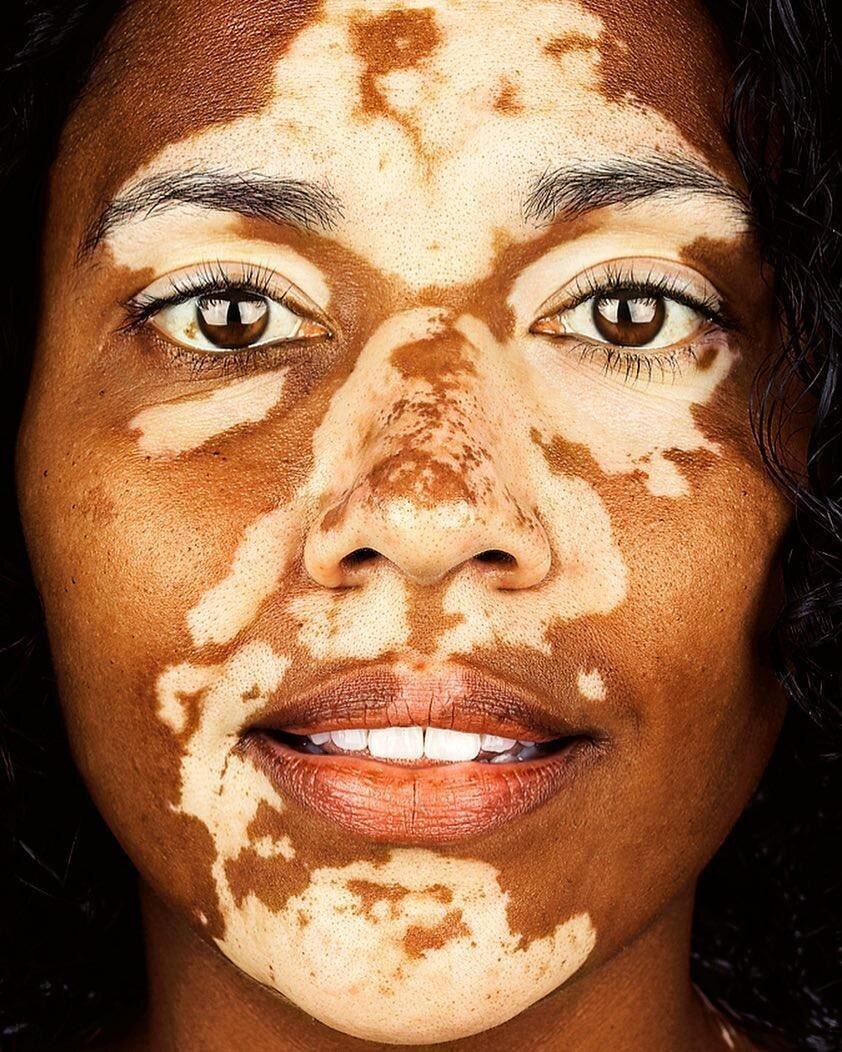 Фото взято из источника