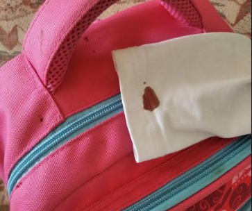 Оставшиеся следы на блузке и рюкзаке.