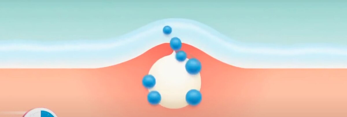 Чудотворные средства от прыщей