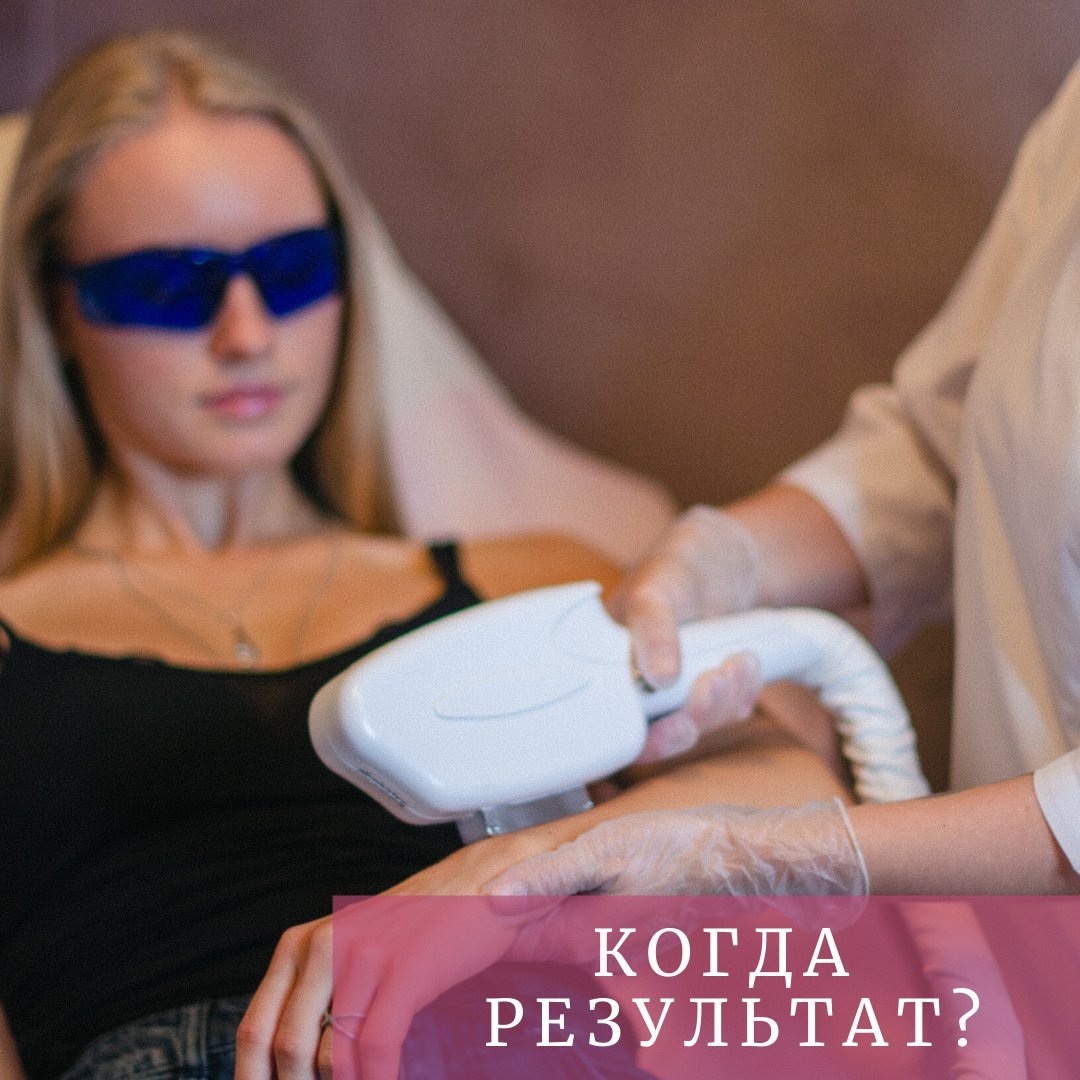 Количество процедур для достижения безупречной гладскости кожи-всегда индивидуально и зависит от многих факторов.