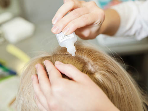 Лечение себореи.