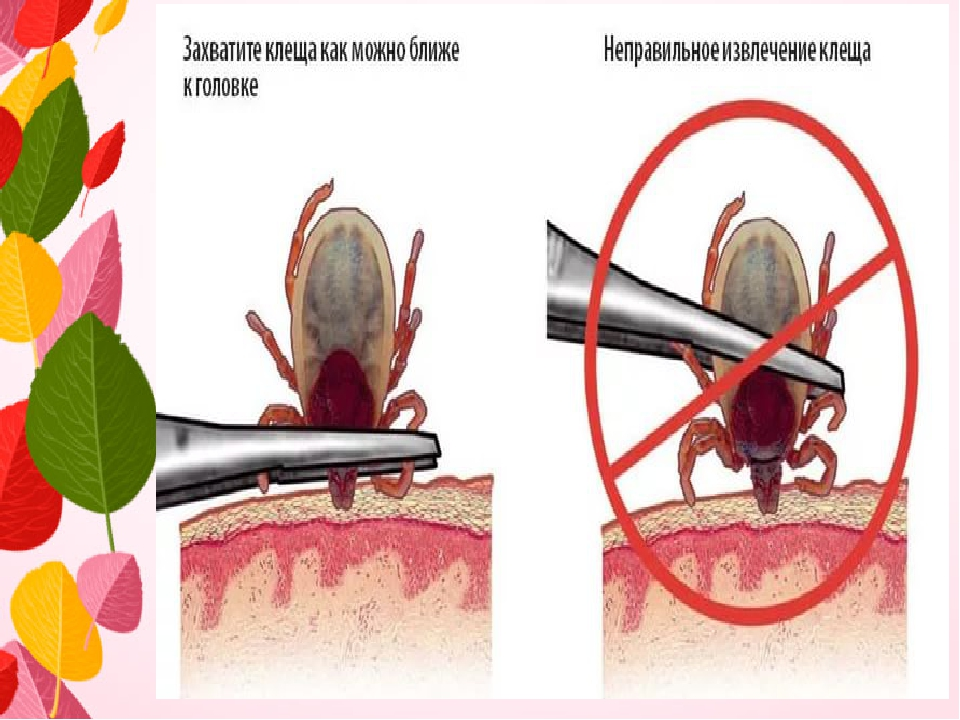 Клещевой энцефалит картинки для детей