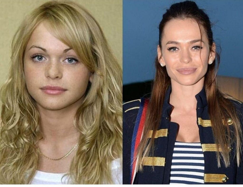 ксения собчак до и после пластики. светлана лобода без пластики. анна седокова до пластики. российские звезды до и после пластики. нос ольги бузовой.