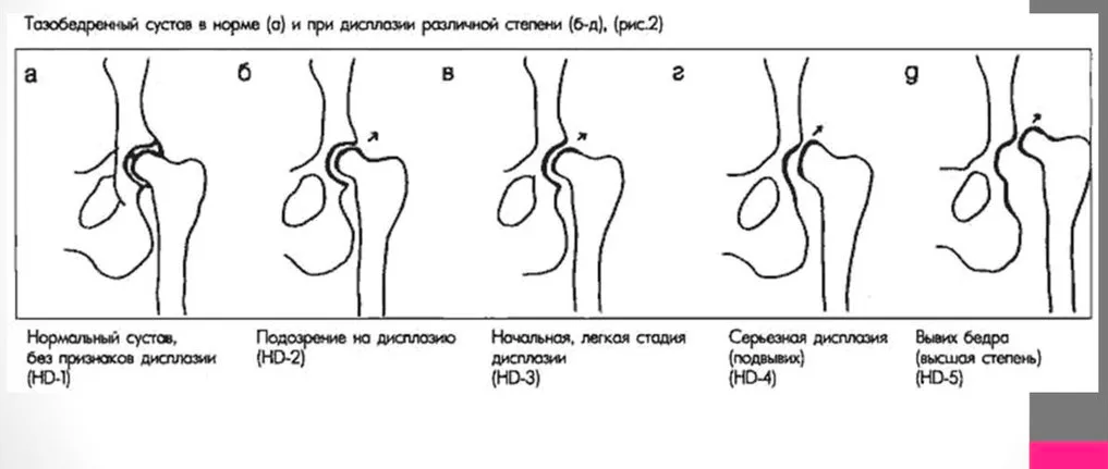 Тазобедренный сустав у собаки. Подвывих тазобедренного сустава классификация. Дисплазия тазобедренного сустава на рентгенограмме. Дисплазия тазобедренных суставов у детей классификация. Степени дисплазии тазобедренных суставов у собак.