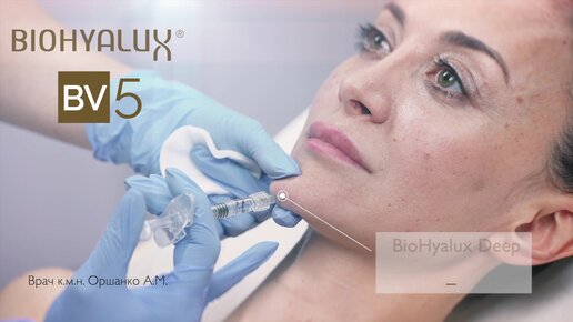 Biohyalux филлер. BIOHYALUX биоревитализация. BIOHYALUX филлер для губ. Филлер BIOHYALUX Deep dermis. BIOHYALUX Mevita 18 как колоть.