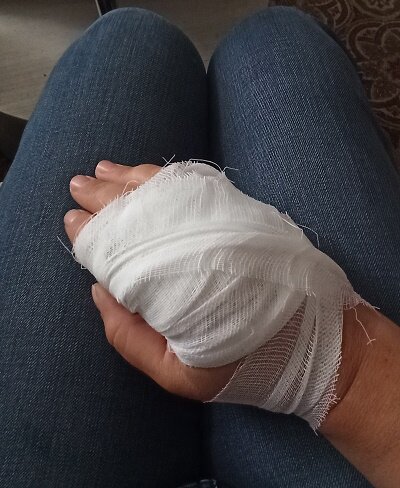 Болит сильно