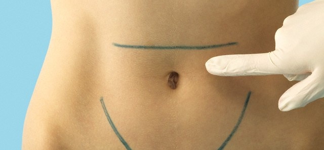 Данная область брюшной полости человека не имеет мышечного покрытия, она и является наиболее уязвимой для возникновения грыжи. Но кроме этого, существуют ещё причины, по которым данный недуг может появиться.