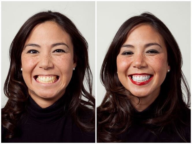 Белые зубы делают женщину моложе
