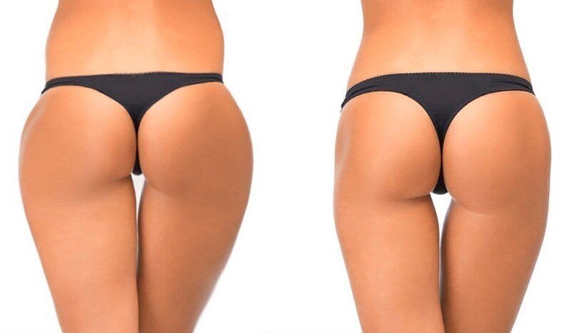 ПОПИНЫ УШКИ