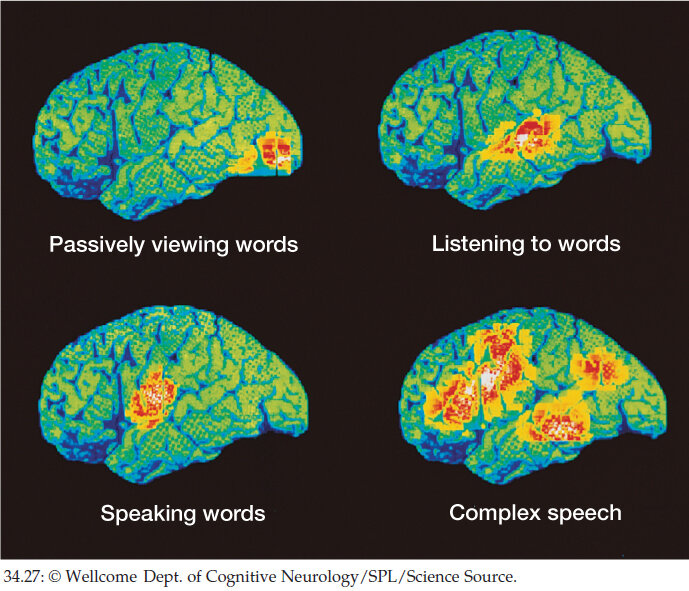  фМРТ активность мозга при 1. Рассматривание слова, 2. Прослушивания слова 3. Произношения слова 4. Во время общения