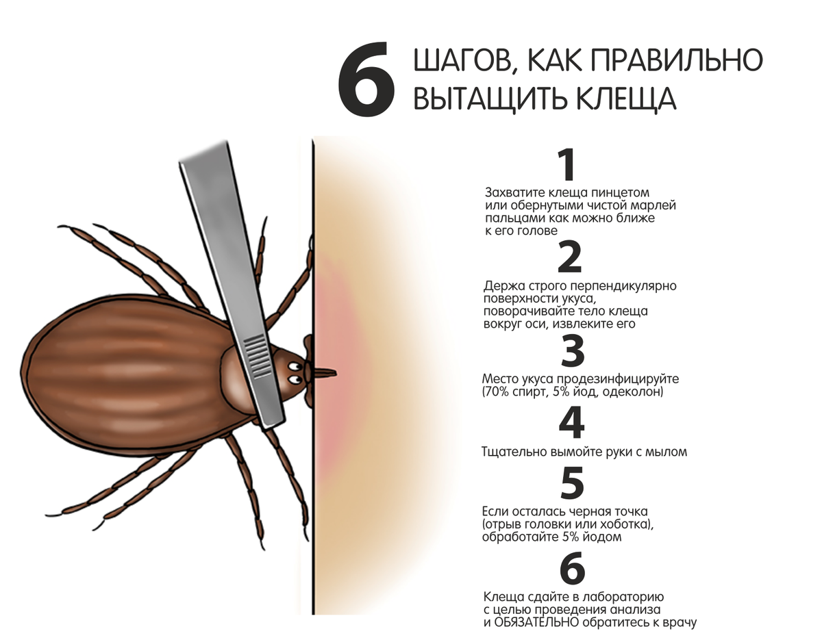 Что делать с ранним семяизвержением?