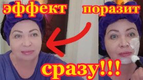 Download Video: ПРОСТО СМЕШАЙТЕ Соду со Сметаной...И Нанесите на лицо Вечером. ЭФФЕКТ ПОРАЗИТ!Отбеливание,Увлажнение и Омоложение на 10 лет!