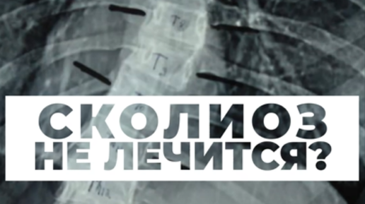 Блог Доктора Шишонина | Сколиоз не лечится - это правда? | Дзен