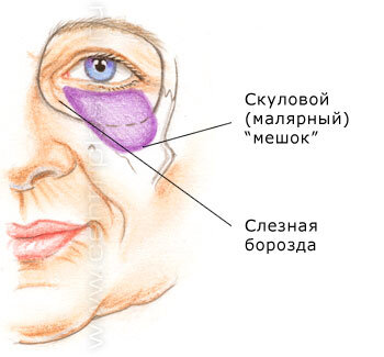 Провалы глаз и лица вглубь