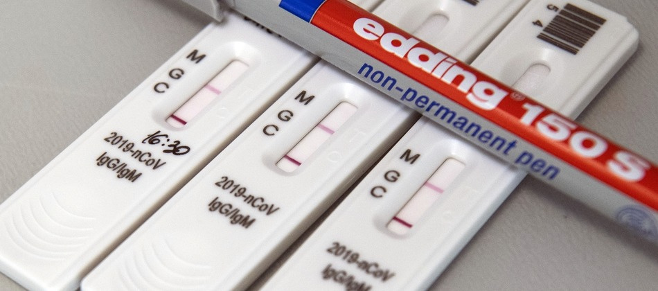 Иммуноглобулиновый экспресс- тест на ковид