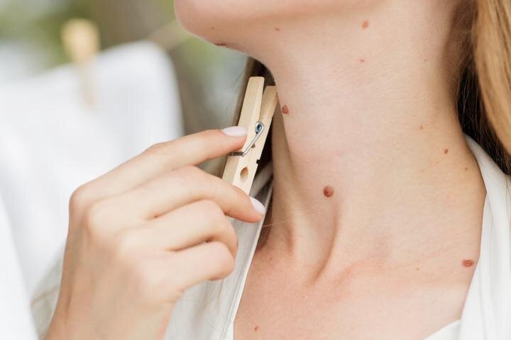 Фото: pixabay.com