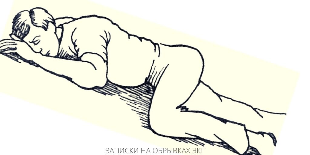 Записки на обрывках
