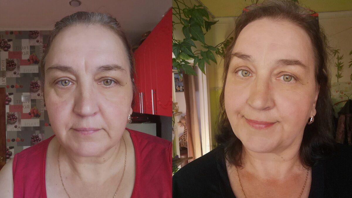 Утро добрым не бывает. А после реанимации я снова молодая