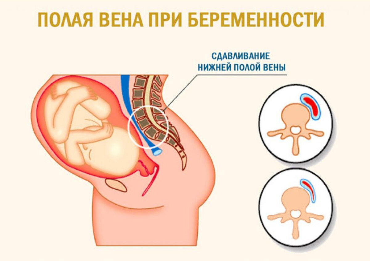 Проблемы со сном во время беременности в вопросах и ответах | Буду лучшей  мамой с ФЭСТ | Дзен