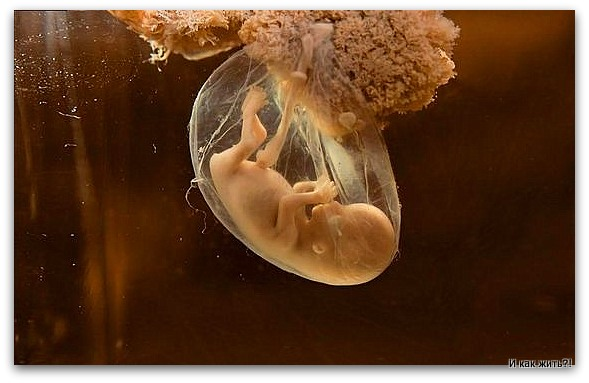 3D-фото пузожителя