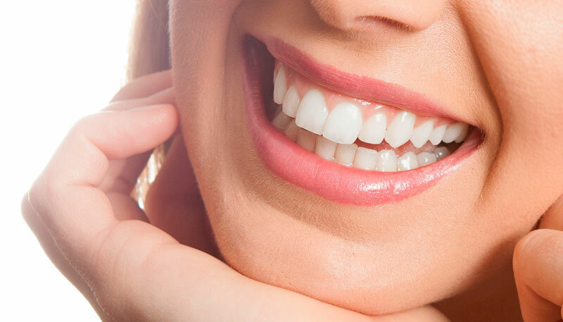 красивая улыбка