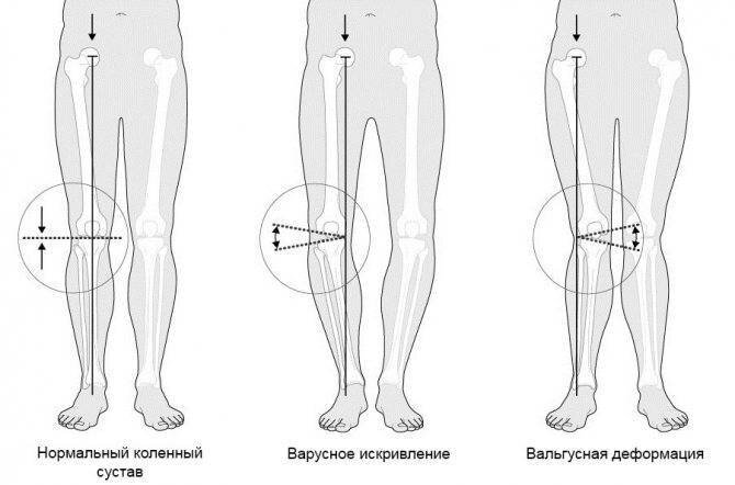 Здоровым такой сустав быть не может.