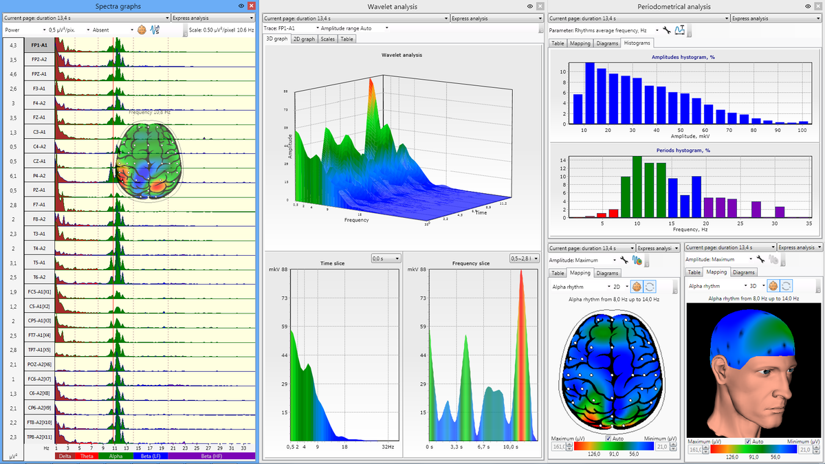 Современное программное обеспечение для регистрации и анализа ЭЭГ |  Электроэнцефалография | Дзен