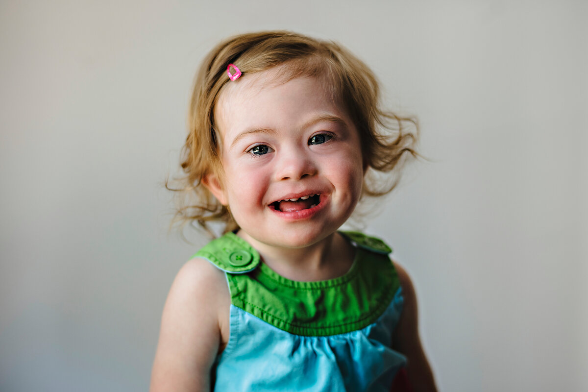 Фотографии детей с синдромом дауна