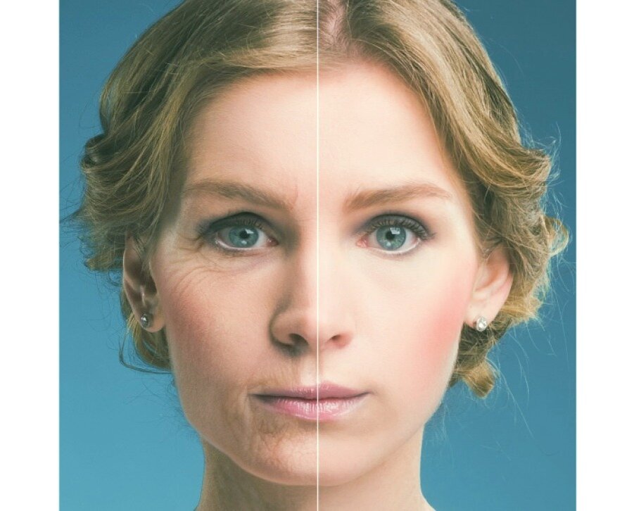 Повернуть время вспять, не обращаясь к хирургам-вполне выполнимая миссия